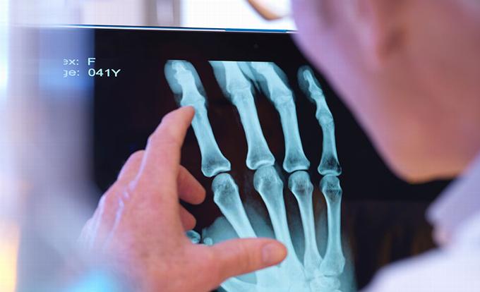 doctor inspecting hand xray