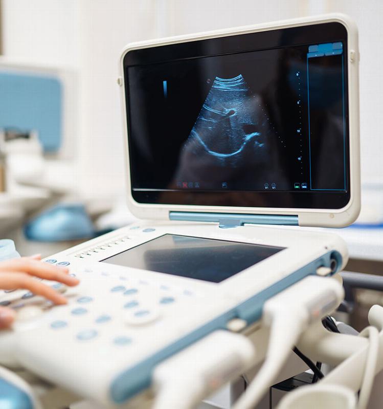 ultrasound results on screen of ultrasound machine